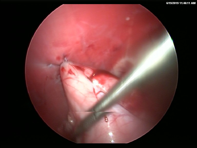 surgery-5